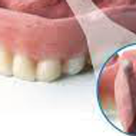 logo-novus-soft-dental-liner